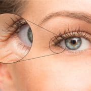 Close-up of a woman's blue eye and eyebrow, with an inset magnifying a wrinkle near the outer corner—highlighting fine lines and skin texture. Discover how Aesthetics By Boss can be your beauty booster for smoother, younger-looking skin.